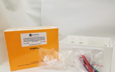 Urine Protein Isolation Made Simple: A Reliable Tool for Biomarker Discovery