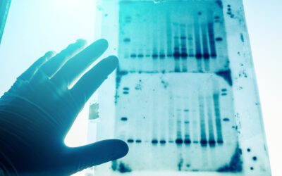 Understanding the Importance and Intricacies of the Application of Western Blot in Medical Tests