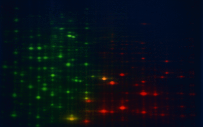 See the Difference: How 2D-DIGE Enhances Accuracy in Comparative Proteomics